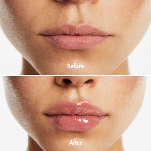 Lip Plumper