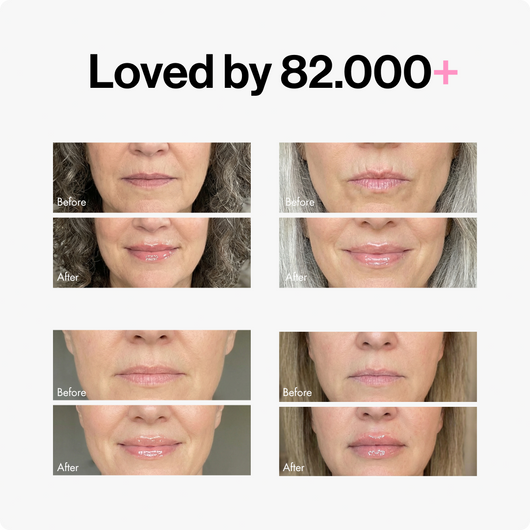 Lip Plumper
